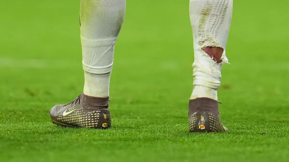 PG电子app下载-球袜被直接踢破！姆巴佩遭拜仁后卫塔犯规后，血痕清晰可见